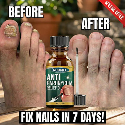Anti Paronychia Relief Oil for Nail Infection & Ingrown Nails | Buy 1 Get 1 FREE