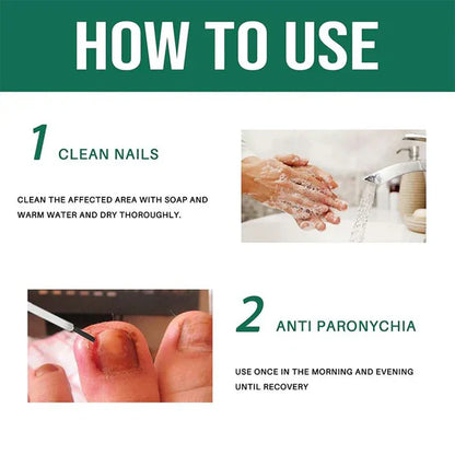 Anti Paronychia Relief Oil for Nail Infection & Ingrown Nails | Buy 1 Get 1 FREE